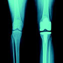 Solutions for the Orthopedic Market